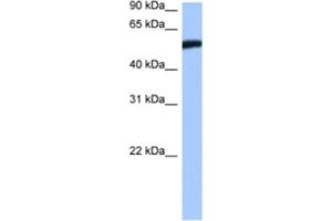 Western Blotting (WB) image for anti-High-Mobility Group 20A (HMG20A) antibody (ABIN2460562) (HMG20A 抗体)