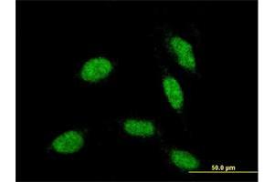 Immunofluorescence of monoclonal antibody to RAX on HeLa cell.