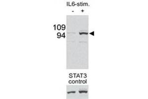 Western Blotting (WB) image for anti-Signal Transducer and Activator of Transcription 3 (Acute-Phase Response Factor) (STAT3) (pSer727) antibody (ABIN3032570)
