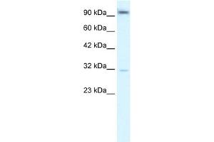 WB Suggested Anti-AHR Antibody Titration:  2. (Aryl Hydrocarbon Receptor 抗体  (N-Term))