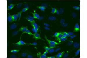 Immunofluorescence (IF) image for anti-Synaptophysin (SYP) (AA 205-306) antibody (ABIN968694) (Synaptophysin 抗体  (AA 205-306))