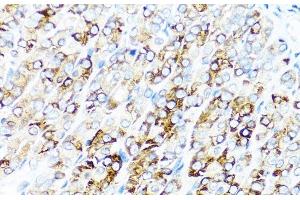 Immunohistochemistry of paraffin-embedded Mouse stomach using SERPINA7 Polyclonal Antibody at dilution of 1:100 (40x lens). (SERPINA7 抗体)