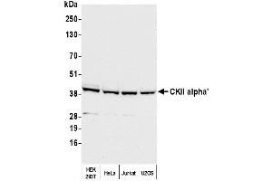 anti-Casein Kinase 2 alpha 1 (CSNK2A1) (C-Term) antibody