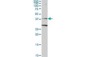 RAD51C monoclonal antibody (M01), clone 3F3-5C6. (RAD51C 抗体  (AA 1-134))