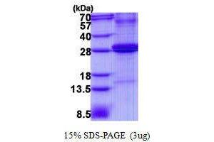 Figure annotation denotes ug of protein loaded and % gel used. (Adipsin 蛋白)