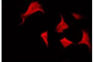 ABIN6266574 staining HepG2 by IF/ICC. (Cytokeratin 5 抗体  (C-Term))
