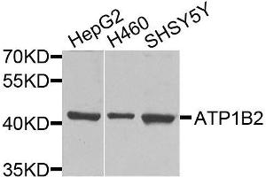 Western Blotting (WB) image for anti-ATPase, Na+/K+ Transporting, beta 2 Polypeptide (ATP1B2) (AA 68-290) antibody (ABIN6137310)