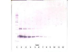 Image no. 1 for anti-Ciliary Neurotrophic Factor (CNTF) antibody (ABIN465750) (CNTF 抗体)