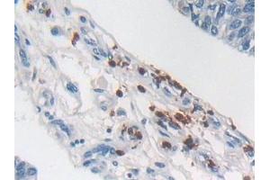 Immunohistochemistry (IHC) image for anti-Sema Domain, Immunoglobulin Domain (Ig), Short Basic Domain, Secreted, (Semaphorin) 3E (SEMA3E) (AA 32-516) antibody (ABIN7430111)