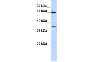 WB Suggested Anti-GTF2B Antibody Titration: 0. (GTF2B 抗体  (C-Term))