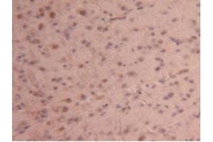 IHC-P analysis of Mouse Brain Tissue, with DAB staining. (CPB2 抗体  (AA 187-327))