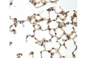 Immunohistochemistry of paraffin-embedded Mouse lung using GSS Polyclonal Antibody at dilution of 1:200 (40x lens). (Glutathione Synthetase 抗体)