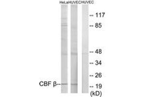 Western blot analysis of extracts from HuvEc/HeLa cells, using CBF beta Antibody. (CBFB 抗体  (AA 11-60))