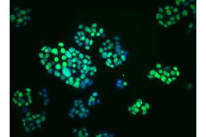 Immunoflourescent staining of PDX-1 in mouse pancreatic tumor (insulinoma) cells.