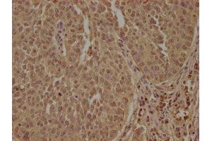 Immunohistochemistry (IHC) image for anti-Protein Phosphatase 1, Regulatory Subunit 13 Like (PPP1R13L) (AA 83-102) antibody (ABIN7140106)