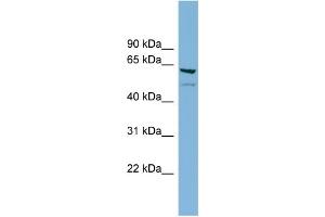 WB Suggested Anti-C7orf43 Antibody Titration: 0. (C7orf43 抗体  (Middle Region))