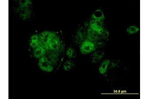 Immunofluorescence of monoclonal antibody to MEF2A on MCF-7 cell. (MEF2A 抗体  (AA 71-170))