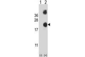Western Blotting (WB) image for anti-Destrin (Actin Depolymerizing Factor) (DSTN) (AA 77-106), (Middle Region) antibody (ABIN951894)