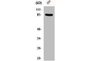 Western Blot analysis of 293 cells using Phospho-Cortactin (Y466) Polyclonal Antibody (Cortactin 抗体  (pTyr466))