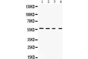 Western Blotting (WB) image for anti-Potassium Voltage-Gated Channel, Shaker-Related Subfamily, Member 2 (KCNA2) (AA 466-499), (C-Term) antibody (ABIN3043865) (KCNA2 抗体  (C-Term))