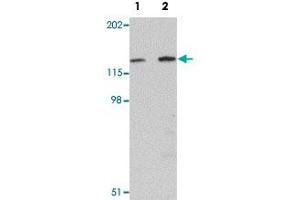 Western blot analysis of mouse skeletal muscle tissue with MYBPC2 polyclonal antibody  at (Lane 1) 1 and (Lane 2) 2 ug/mL dilution. (MYBPC2 抗体  (C-Term))