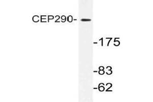Western blot (WB) analysis of CEP290 antibody in extracts from K562 cells. (CEP290 抗体)