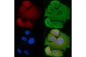 ABIN6257299 and ABIN6275373 staining Hela cells by IF/ICC. (KCNK17 抗体)