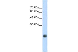 Western Blotting (WB) image for anti-Transmembrane Protein 178A (TMEM178A) antibody (ABIN2462646) (TMEM178 抗体)