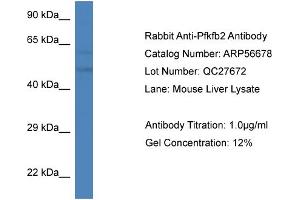 Western Blotting (WB) image for anti-6-phosphofructo-2-Kinase/fructose-2,6-Biphosphatase 2 (PFKFB2) (C-Term) antibody (ABIN2786834) (PFKFB2 抗体  (C-Term))