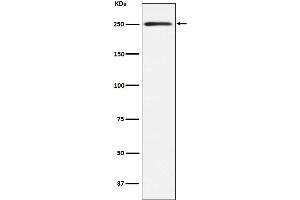 Western blot analysis of Myosin, smooth muscle heavy chain 1 and 2 expression in Human bladder lysate.