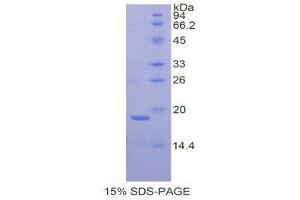 SDS-PAGE (SDS) image for Galectin 7 (LGALS7) (AA 1-128) protein (His tag) (ABIN1079629)