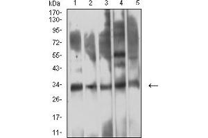Western Blotting (WB) image for anti-Triggering Receptor Expressed On Myeloid Cells 1 (TREM1) (AA 21-205) antibody (ABIN7193250)