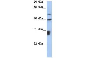 PPIL3 antibody used at 1 ug/ml to detect target protein. (PPIL3 抗体)