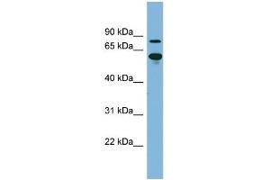 WB Suggested Anti-ABCF2 Antibody Titration:  0. (ABCF2 抗体  (N-Term))