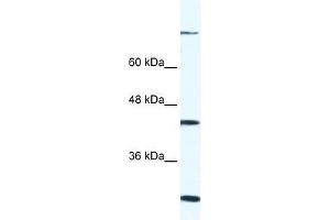 FGD1 antibody used at 0. (FGD1 抗体  (C-Term))