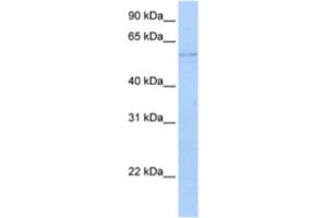 Western Blotting (WB) image for anti-Kynureninase (L-Kynurenine Hydrolase) (KYNU) antibody (ABIN2462923) (KYNU 抗体)