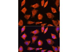 Immunofluorescence analysis of L929 cells using SEC11A Rabbit pAb (ABIN6133117, ABIN6147478, ABIN6147479 and ABIN6214843) at dilution of 1:100. (SEC11A 抗体  (AA 37-145))