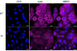 Immunocytochemical staining of HepG2 cells using EGFR antibody (ABIN7798461), 1:1,000), Top panel: wild-type (WT), Bottom panal: EGFR shRNA knockdown (KD). (Recombinant EGFR 抗体)