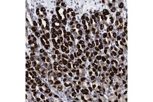 Immunohistochemical staining of human stomach with RSAD1 polyclonal antibody  shows strong cytoplasmic positivity in Parietal cells.