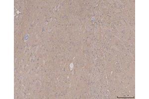 IHC analysis of Tau/MAPT using anti-Tau/MAPT antibody (ABIN7599268). (MAPT 抗体  (AA 1-322))
