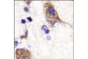 Formalin-fixed and paraffin-embedded human brain tissue reacted with SCYL2 (C-term), which was peroxidase-conjugated to the secondary antibody, followed by DAB staining. (SCYL2 抗体  (C-Term))