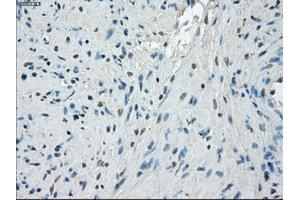Immunohistochemical staining of paraffin-embedded endometrium tissue using anti-PPP5Cmouse monoclonal antibody. (PP5 抗体)