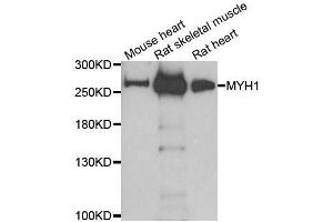 Western blot analysis of extracts of various cell lines, using MYH1 antibody. (MYH1 抗体  (AA 1-100))