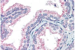 Human Prostate (formalin-fixed, paraffin-embedded) stained with NAB1 antibody ABIN462173 followed by biotinylated goat anti-rabbit IgG secondary antibody ABIN481713, alkaline phosphatase-streptavidin and chromogen. (NAB1 抗体  (AA 71-120))
