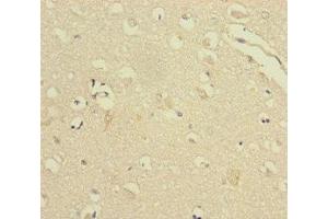 Immunohistochemistry of paraffin-embedded human brain tissue using ABIN7175312 at dilution of 1:100 (VPS33B 抗体  (AA 348-617))