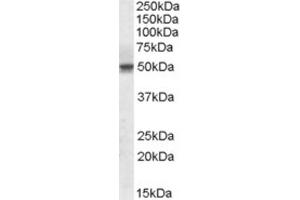 Western Blotting (WB) image for anti-Septin 6 (SEPT6) (Internal Region) antibody (ABIN2464150) (Septin 6 抗体  (Internal Region))