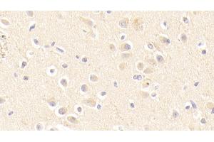 Immunohistochemistry (IHC) image for anti-Apolipoprotein E (APOE) (AA 19-181) antibody (ABIN7429133)