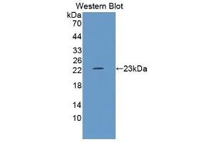 Western Blotting (WB) image for anti-Growth Arrest and DNA-Damage-Inducible, alpha (GADD45A) (AA 1-165) antibody (ABIN1868086) (GADD45A 抗体  (AA 1-165))