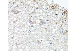Immunohistochemistry of paraffin-embedded Rat brain using METTL13 Polyclonal Antibody at dilution of 1:100 (40x lens). (METTL13 抗体)