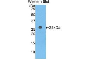 Western Blotting (WB) image for anti-alpha-1-B Glycoprotein (A1BG) (AA 220-415) antibody (ABIN3201752) (A1BG 抗体  (AA 220-415))